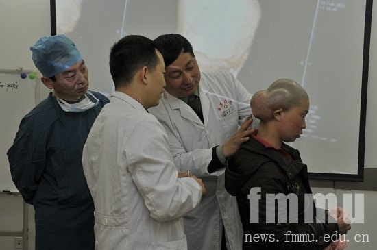 西京医院成功为一患者切除头部巨大肿瘤