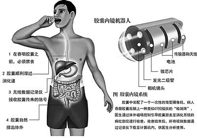 《解放军报》:我国首台可定位可遥控的胶囊内镜机器人研制成功